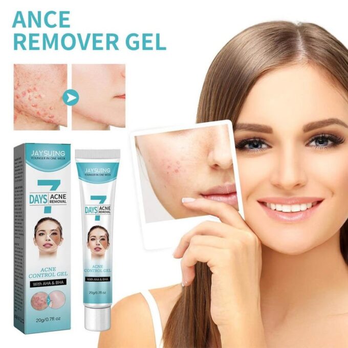 Crema tratamiento acne mascarilla facial FK23B-39